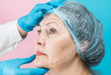 Understanding Cosmetic Surgery Prices and Plastic Surgery Price Trends in 2025