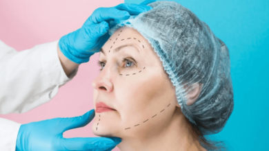 Understanding Cosmetic Surgery Prices and Plastic Surgery Price Trends in 2025